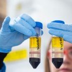 Vaccins Covid-19 : l’OMS voit enfin la lumière au bout du tunnel