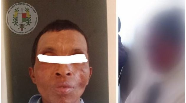 Madagascar : Une jeune fille de 12 ans fait arrêter son violeur de beau-père
