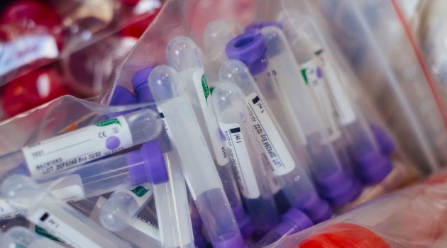 Covid-19 : l’OMS est en contact avec Moscou pour évaluer l’efficacité du vaccin russe