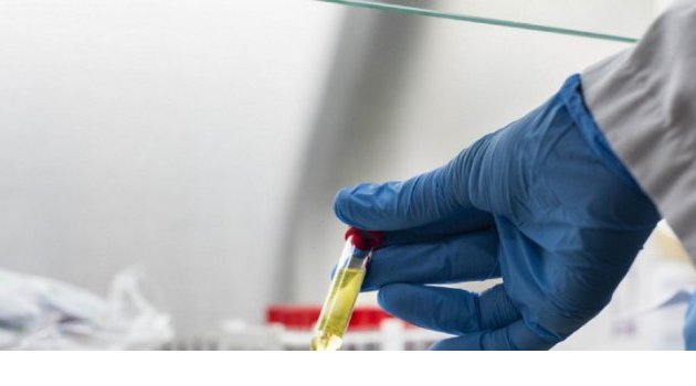 Covid-19 : les tests rapides antigènes vont doper les capacités de dépistage en Afrique