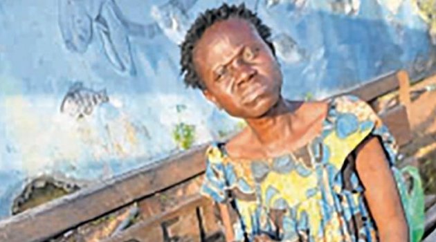 Une gabonaise atteinte d’une maladie rare crie à l’aide à Lambaréné
