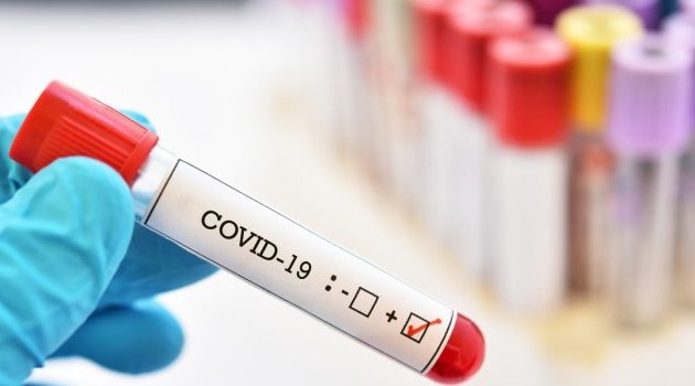 Le Copil Coronavirus dénonce le trafic de faux résultats Covid-19 au Gabon