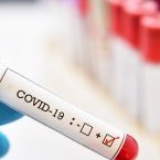 Le Copil Coronavirus dénonce le trafic de faux résultats Covid-19 au Gabon