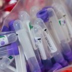 Covid-19 : l’OMS est en contact avec Moscou pour évaluer l’efficacité du vaccin russe