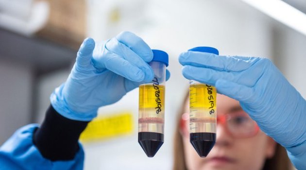 Vaccins Covid-19 : l’OMS voit enfin la lumière au bout du tunnel