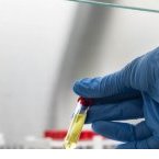 Covid-19 : les tests rapides antigènes vont doper les capacités de dépistage en Afrique